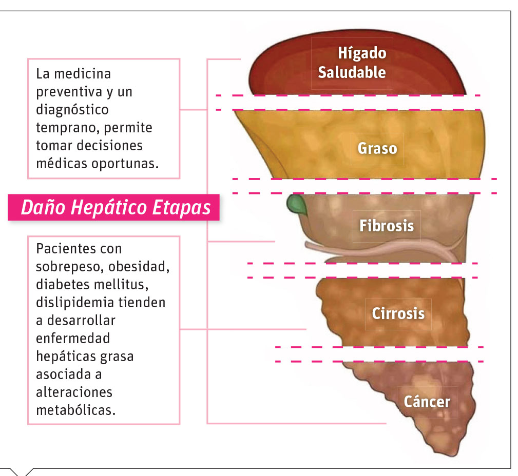 Una evaluación integral de la salud del hígado