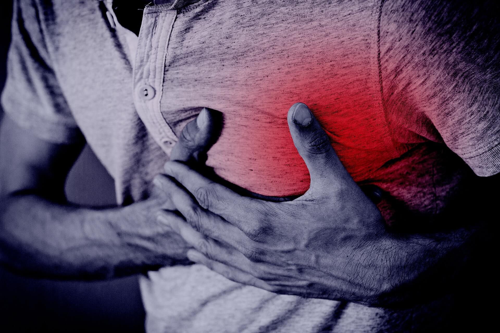 Infarto agudo de miocardio