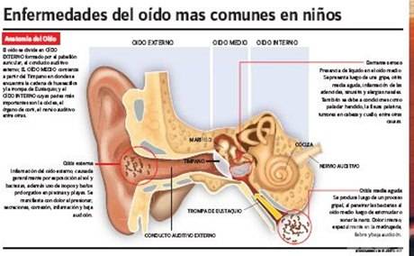 Los peligros de la otitis