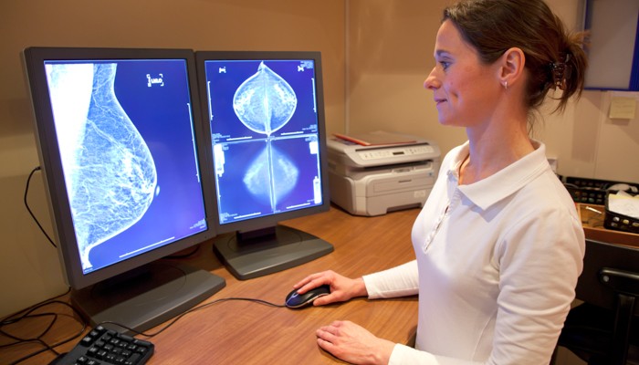 Atención multidisciplinar: un modelo centralizado que acelera el diagnóstico precoz del cáncer