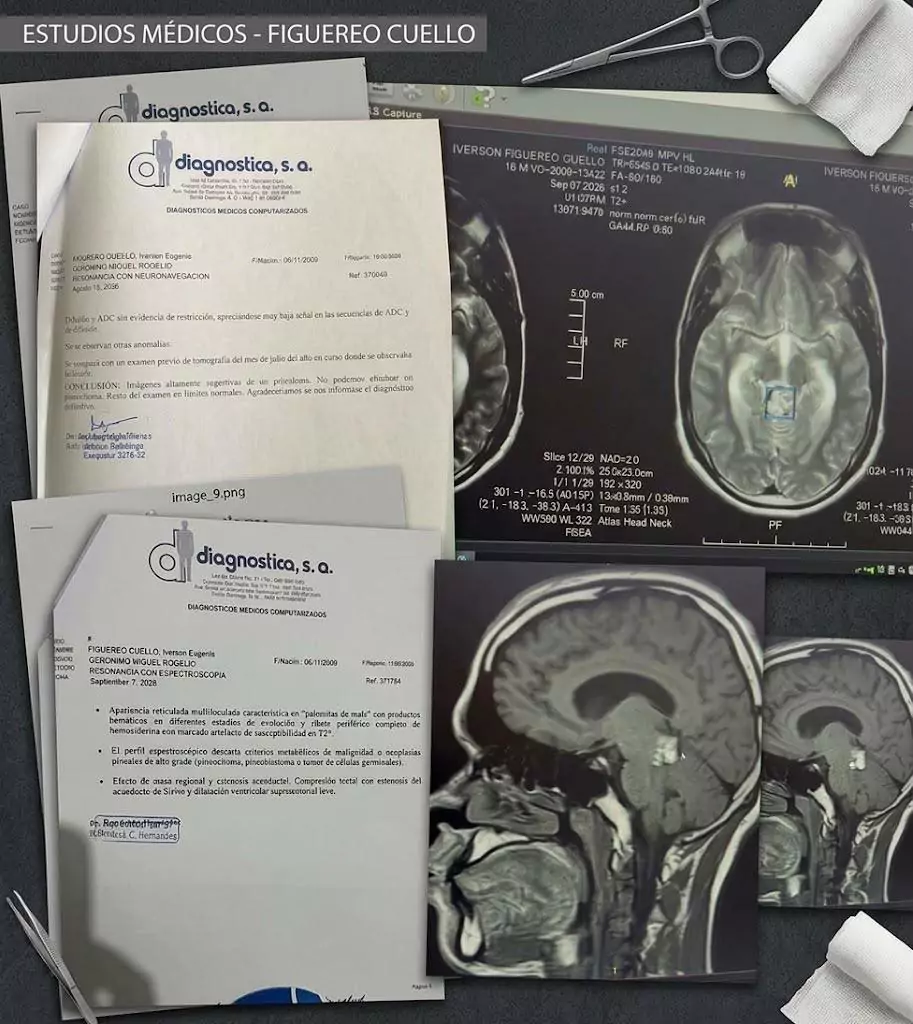 Estudios médicos y resonancias magnéticas cerebrales de Iverson Cuello, joven dominicano que busca apoyo para cirugía